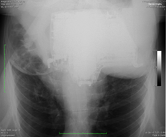 Narcis-Virgiliu.0001 Narcis-Virgiliu.0001