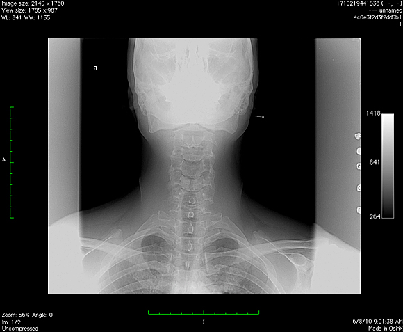 Narcis-Virgiliu.0006 Narcis-Virgiliu.0006