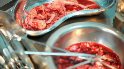 Moments of Truth – Mommy! Why…? © Photography  by Narcis Virgiliu