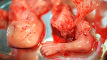 Moments of Truth – Mommy! Why…? © Photography  by Narcis Virgiliu