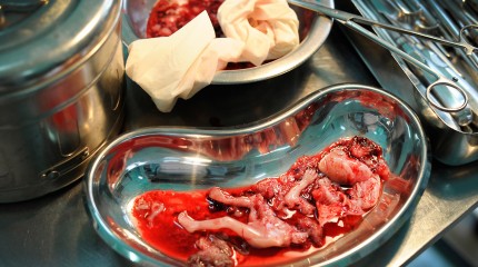 Moments of Truth – Mommy! Why…? © Photography  by Narcis Virgiliu